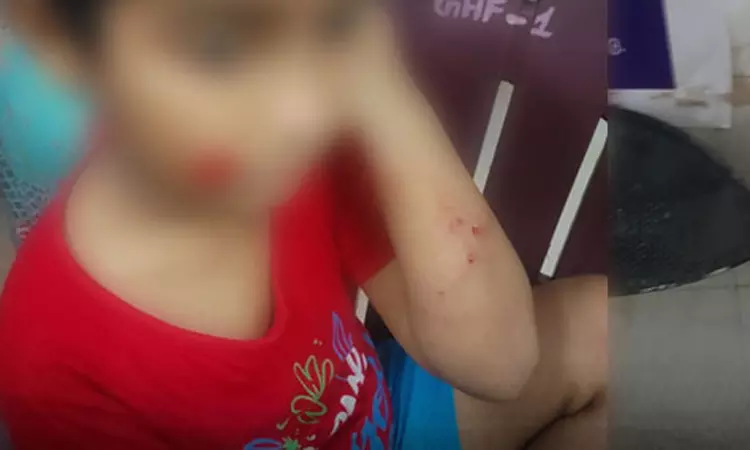 சென்னை போரூர் அருகே அதிர்ச்சி: டியூஷன் சென்ற சிறுவனை கடித்துக்குதறிய தெருநாய் சென்னை போரூர் அருகே அதிர்ச்சி: டியூஷன் சென்ற சிறுவனை கடித்துக்குதறிய தெருநாய்