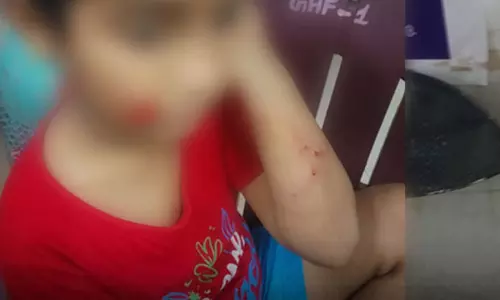 சென்னை போரூர் அருகே அதிர்ச்சி: டியூஷன் சென்ற சிறுவனை கடித்துக்குதறிய தெருநாய்