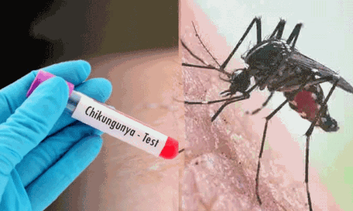 தமிழகத்தில் அதிகரிக்கும் சிக்குன் குனியா பாதிப்பு.. பொது சுகாதாரத்துறை எச்சரிக்கை.!