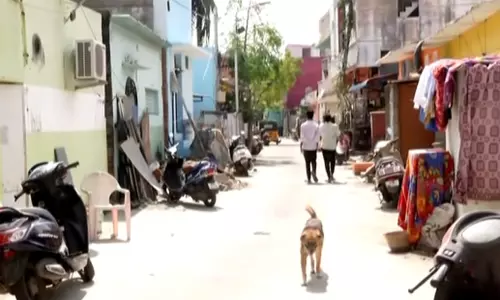 சென்னையில் வளர்ப்பு நாய் கடித்து சிறுவன் படுகாயம் சென்னையில் வளர்ப்பு நாய் கடித்து சிறுவன் படுகாயம்