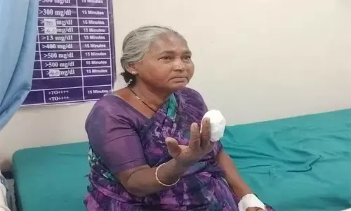 கரூர்: வெறிநாய் கடித்து மூதாட்டியின் கை விரல் துண்டானது - அதிர்ச்சி சம்பவம்